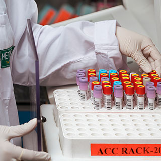 Pcr full form rt Reverse transcription