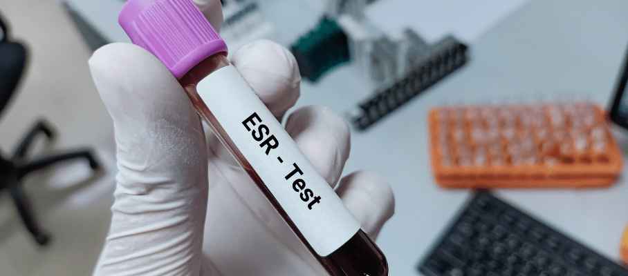 Erythrocyte Sedimentation Rate (ESR)