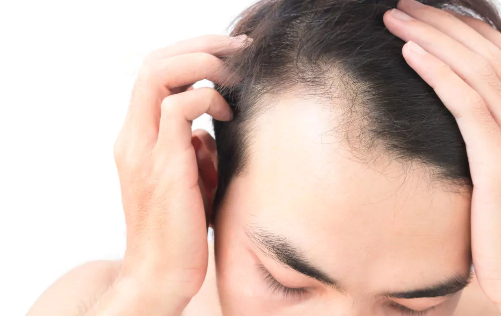 19 Best (& Worst) Male Hairstyles For A Receeding Hairline