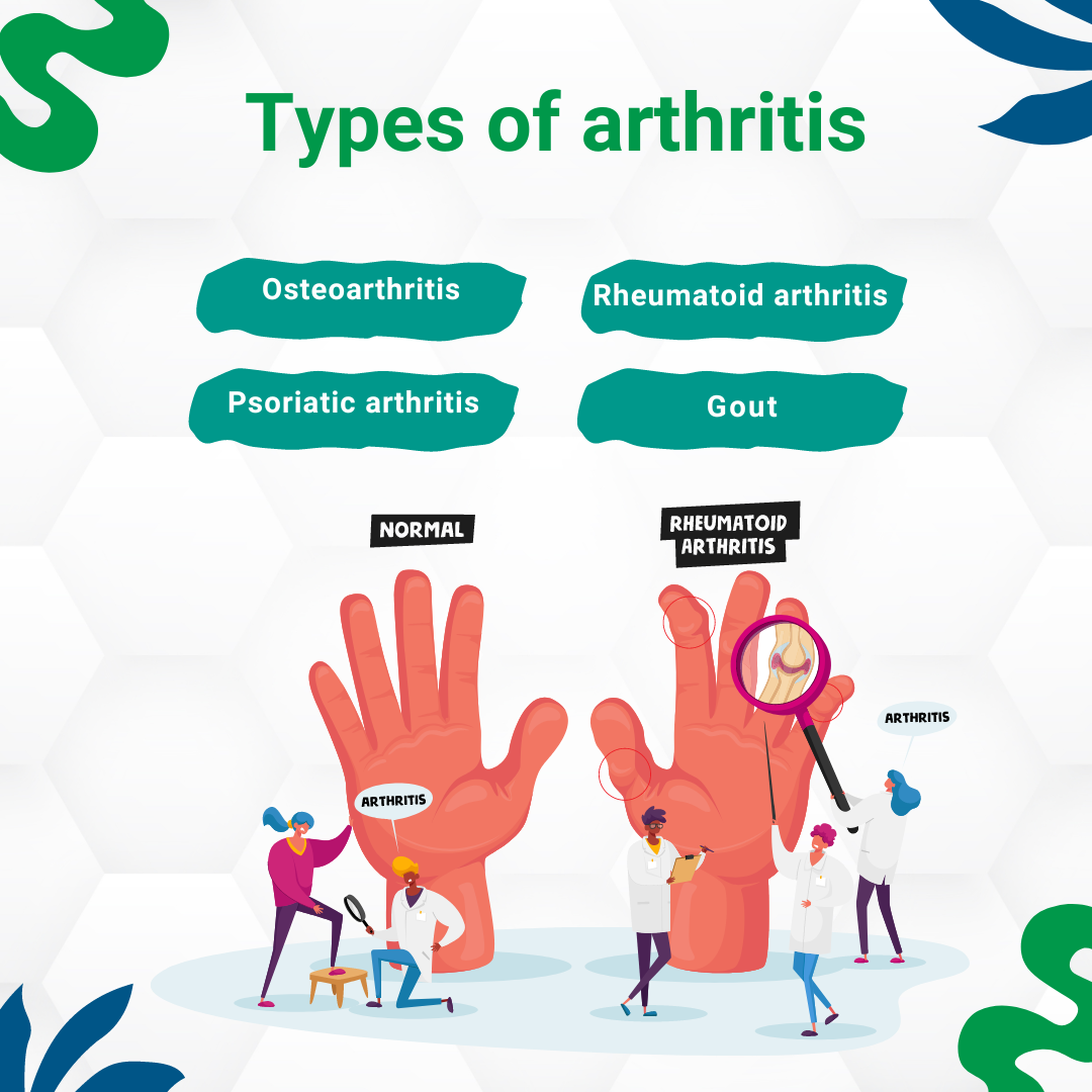 Arthritis: Symptoms, Causes, Types, Treatment & Prevention