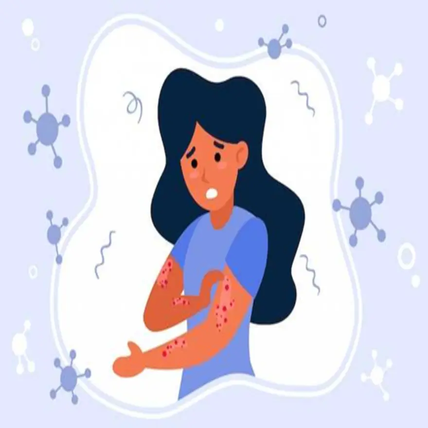Causes, Symptoms, Stages of Pityriasis Rosea