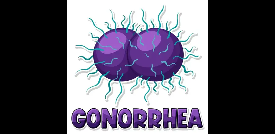 Discover causes, symptoms in men & women of Gonorrhoea