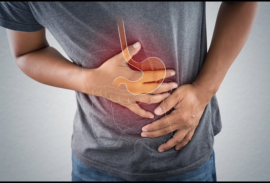 Medication for acid peptic disease