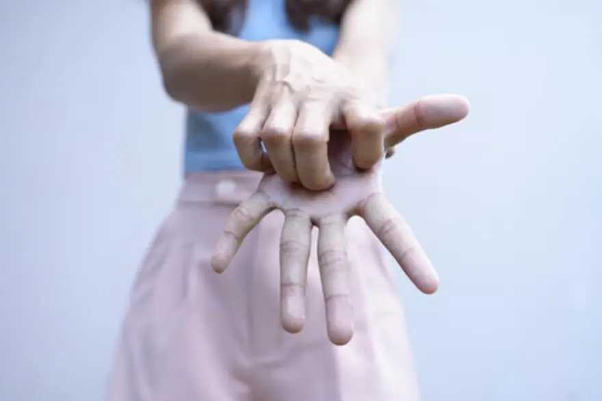 Learn about Ehlers-Danlos Syndrome causes & symptoms