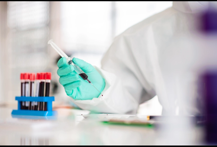 When To Take Dengue NS1 Antigen Test