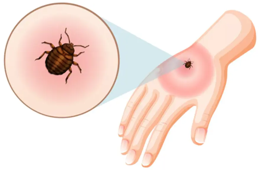 Find out what symptoms to look for and how scrub typhus spreads.