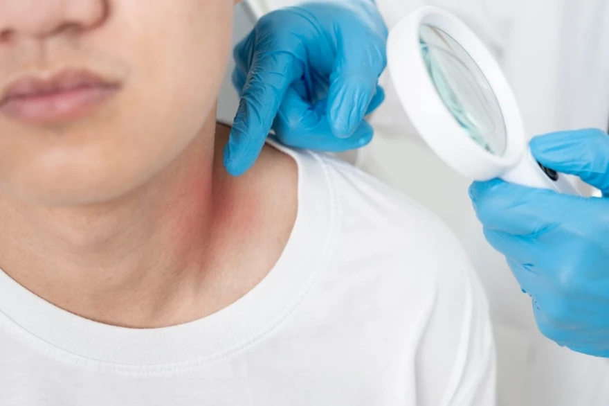 Learn Paraneoplastic Syndromes Sign & Causes