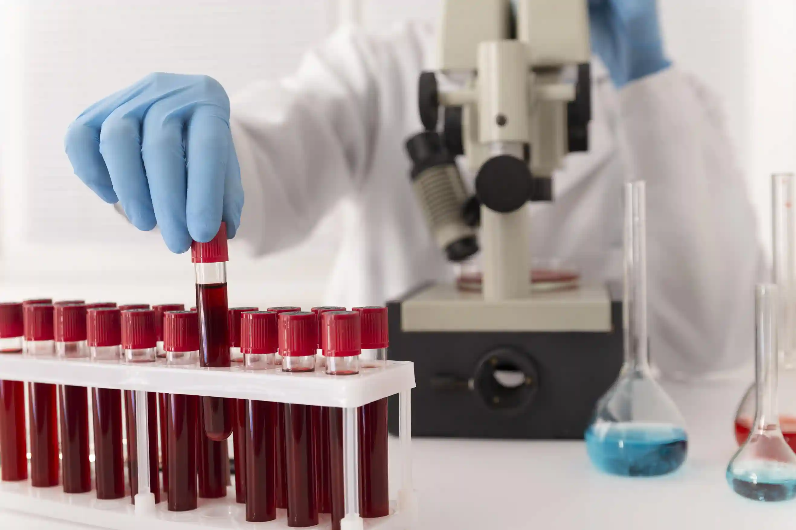 Learn what a bicarbonate blood test measures