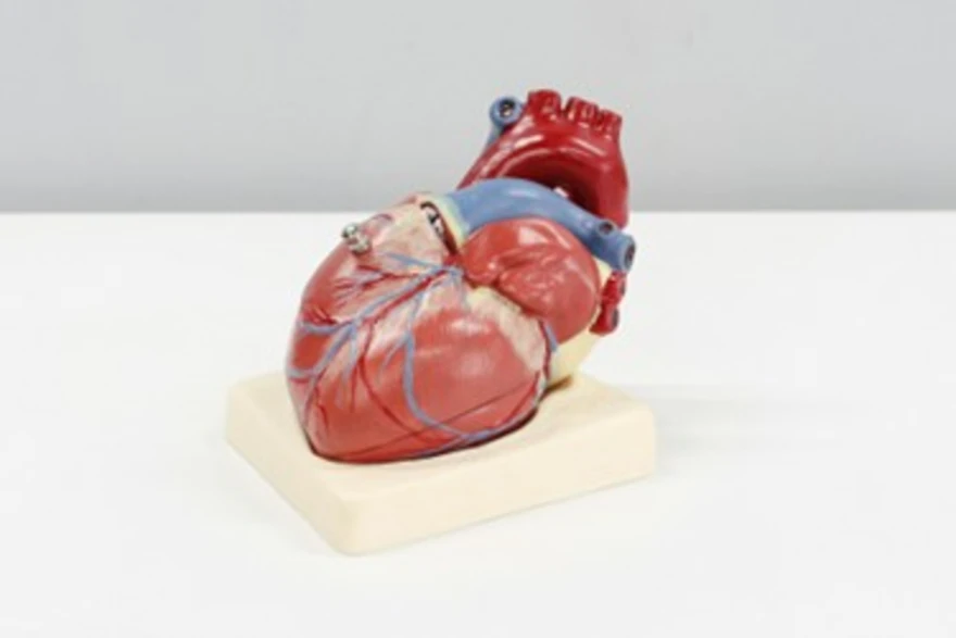 Inflamed pericardium around the heart