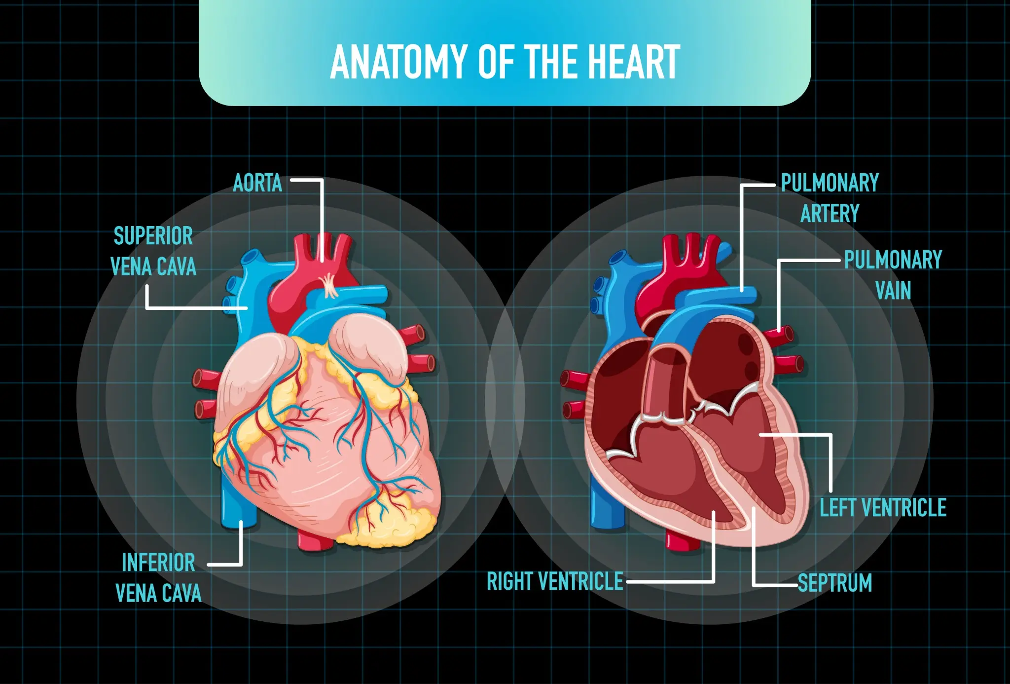 bicuspid aortic valve
