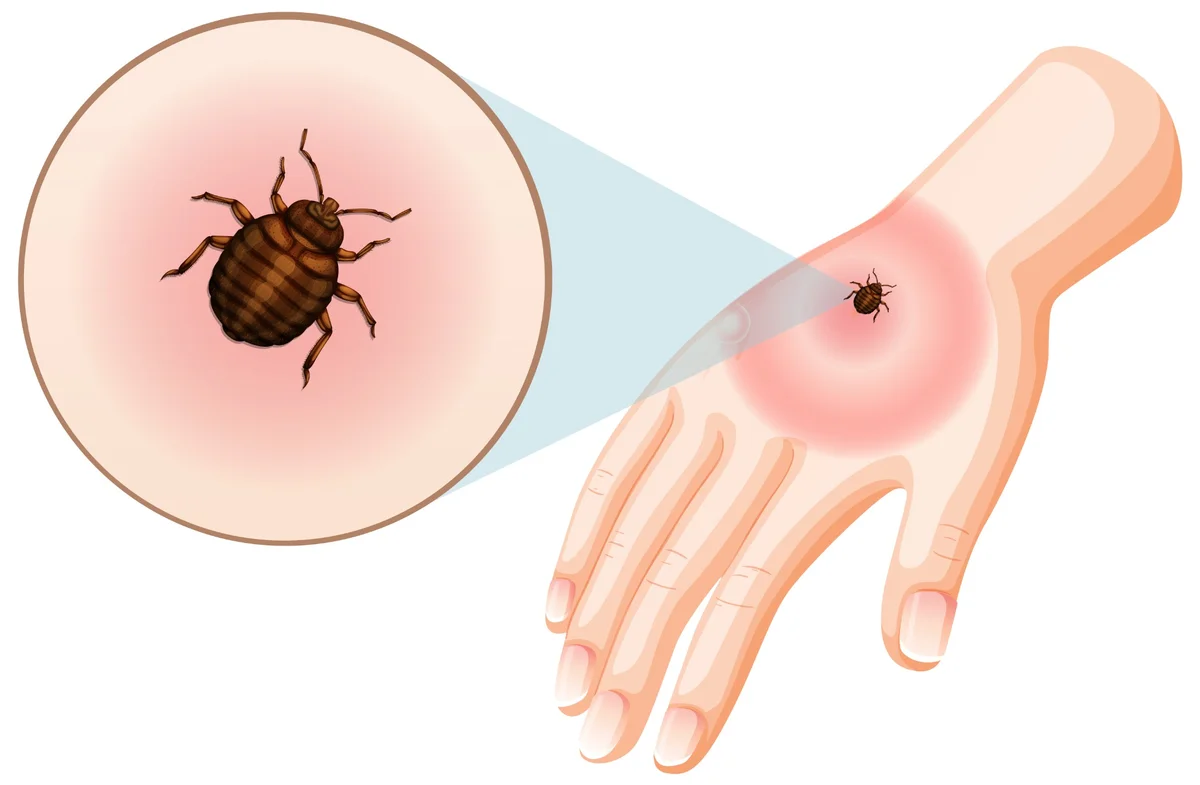Babesia parasites transmitted by ticks