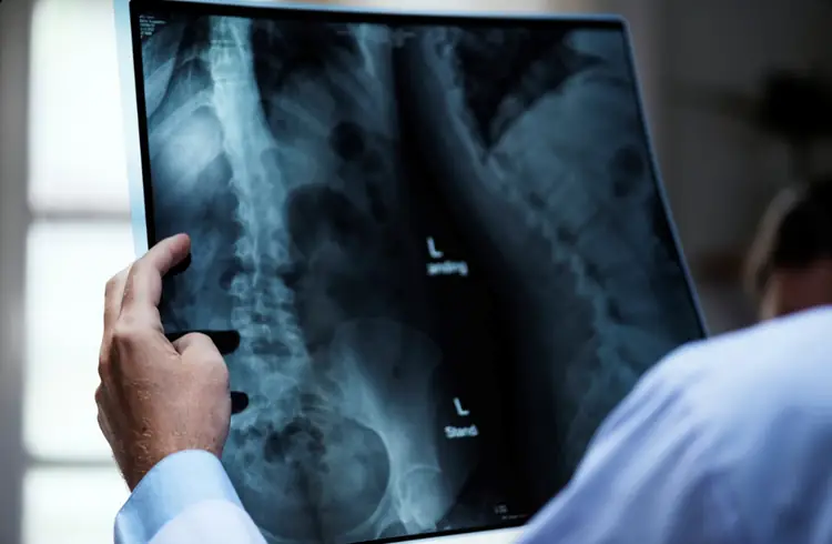 Whole Body Bone Scan Purpose