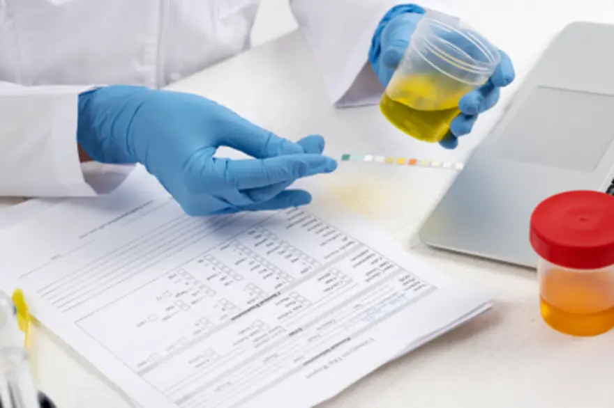 Urine Culture Test Normal Range